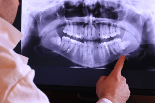 Best Emergency Dental Care for Broken or Chipped Teeth in Church Hill, TN
